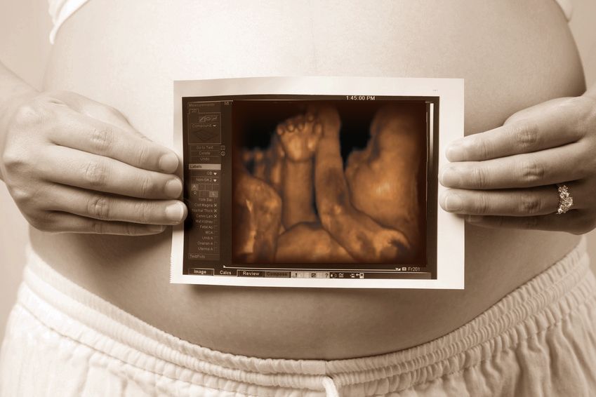 Baby Pictures Prenatal Video Ultrasound. 