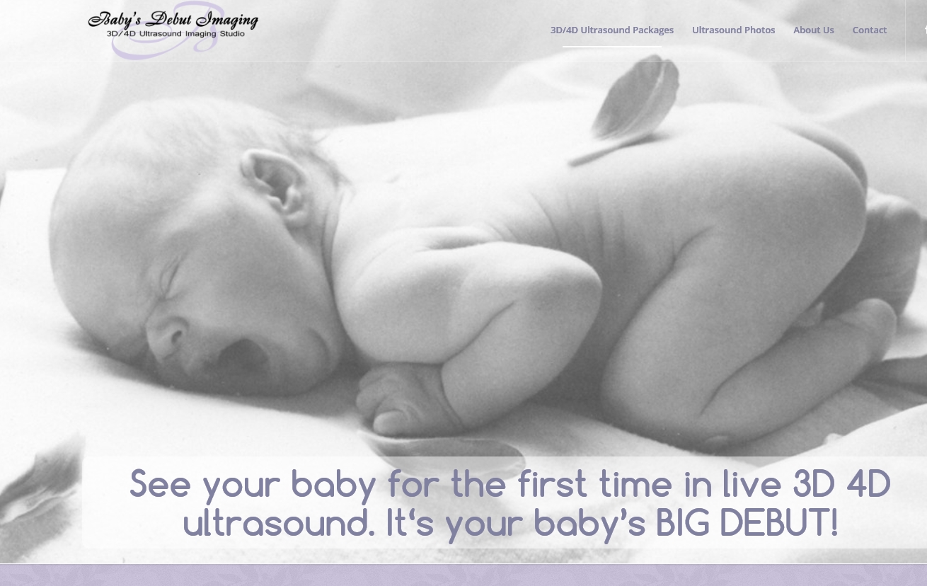 3d 4d Ultrasounds Iriwindale City Of Industry Ca